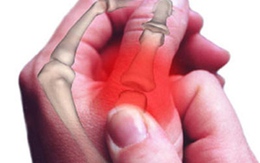 Biểu hiện của bệnh viêm khớp xương mãn tính