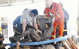 Đứt ruột non vì ngã vào máy trộn than
