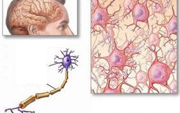 Ngừa suy giảm trí nhớ bằng thuốc 