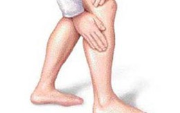 Điều cần biết khi nóng buốt, đau nhức chân