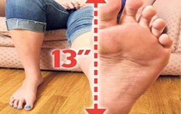 Thiếu nữ có bàn chân... siêu ngoại cỡ 