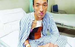 Lạ kỳ người đàn ông có máu tím