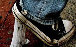 Mẹo làm sạch bã kẹo cao su trên giày dép