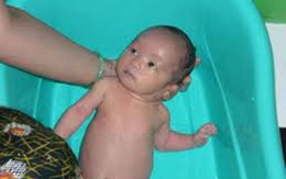 Mẹ chủ quan, con viêm bao quy đầu