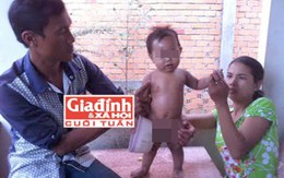 Cậu bé vừa sinh ra đã mang hình thù kỳ lạ