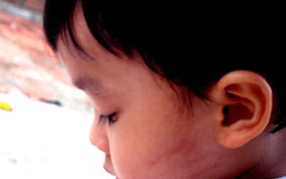 Bảo mẫu tát liên tiếp vào mặt bé 2 tuổi