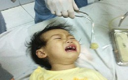 Bé 2 tuổi suýt chết vì hóc nho