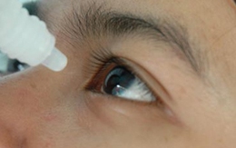 Mù vì thuốc nhỏ mắt