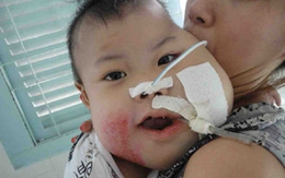Phẫu thuật ngay cho bệnh nhi được đưa đi cấp cứu bằng đường hàng không