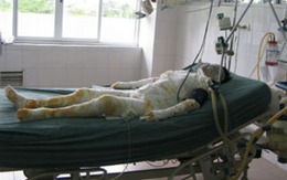 Cháu đích tôn đốt mẹ và 10 người thân"