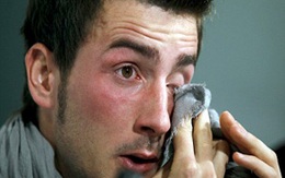 Một cầu thủ trẻ qua đời vì ung thư