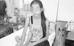 Bé gái mang 2 cơ quan sinh dục suốt 12 năm 
