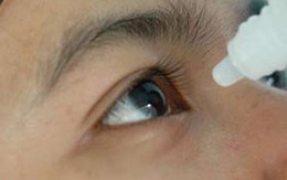 Mù do thói quen dùng thuốc nhỏ mắt