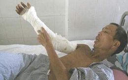 Chữa rắn cắn, bị mất tay