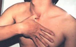 Trị hen suyễn bằng phương pháp cổ truyền