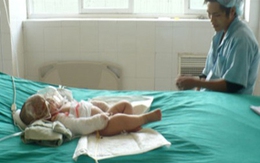 Bị nước sôi đổ lên người, bé 2 tháng tuổi tử vong
