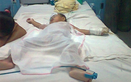 Bé gái bỏng nặng do ngã vào nồi cháo