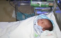 Mổ mắt thành công cho bé gái thứ 2 trong ca sinh 4