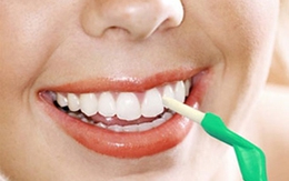 Sinh bệnh do tẩy trắng răng
