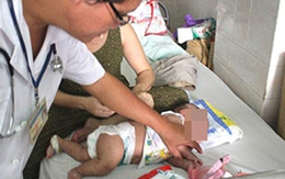 Bí ẩn nguồn lây bệnh ca thứ hai bị amip ăn não