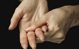 Tư vấn trực tuyến về chẩn đoán và điều trị viêm khớp dạng thấp