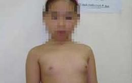 Dậy thì sớm và mối lo hóa chất độc hại rình rập trẻ