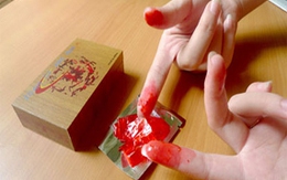 Màng trinh giả gây nguy cơ viêm nhiễm cao
