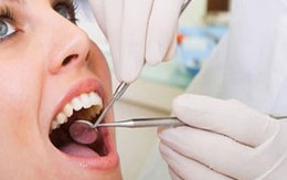 Những điều cần biết về cạo vôi răng