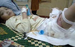 Bé 5 tuổi bị bỏng vì ngã vào nồi canh nóng