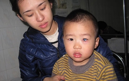 Nghịch gói chống ẩm, bé 2 tuổi bị bỏng mắt