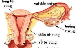 Những "thủ phạm" hủy hoại tử cung người phụ nữ
