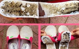 Xôn xao dép Trung Quốc gây lở loét, tê chân