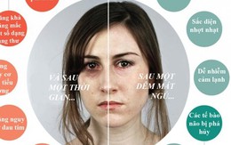 Những hệ lụy khó lường vì mất ngủ