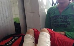 Bé gái 17 tháng tuổi bỏng nặng vì "bom xăng"