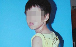 Dì ghẻ tra tấn con chồng tàn độc gây chấn động 