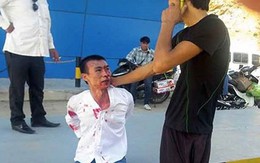 Nam thanh niên bị trói tay, người đầy máu ở trạm thu phí
