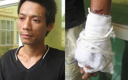 Ca sĩ phòng trà tạt axit vợ vì bị "cắm sừng"