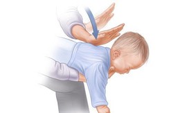 Bé hơn 2 tháng tuổi tử vong nghi do sặc sữa