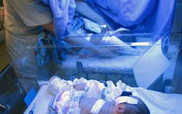 Trẻ sinh non - Những số phận đáng thương