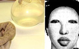 Đạo chích dùng bao cao su làm… "vũ khí"