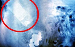 Chó nuốt chửng điện thoại của chủ nhân