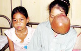 Những hy vọng đầu tiên cho 5 chị em mắc bệnh lạ ở Thái Nguyên