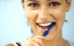Những điều cần biết về nắn chỉnh răng