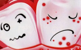 Chăm sóc răng giả: Không phải dễ!