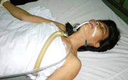 Một nữ hành khách bị phụ xe đánh dập nát lá lách