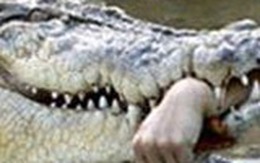 Một thiếu niên 15 tuổi bị cá sấu đớp lìa cánh tay