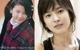 Song Hye Kyo bị nghi ngờ phẫu thuật thẩm mỹ