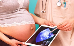 Nỗi đau xé lòng khi có con "dị tật"