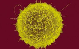 Tế bào T - Hy vọng mới cho cuộc chiến chống HIV/AIDS