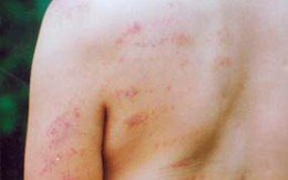 Giám đốc tra tấn học viên khuyết tật